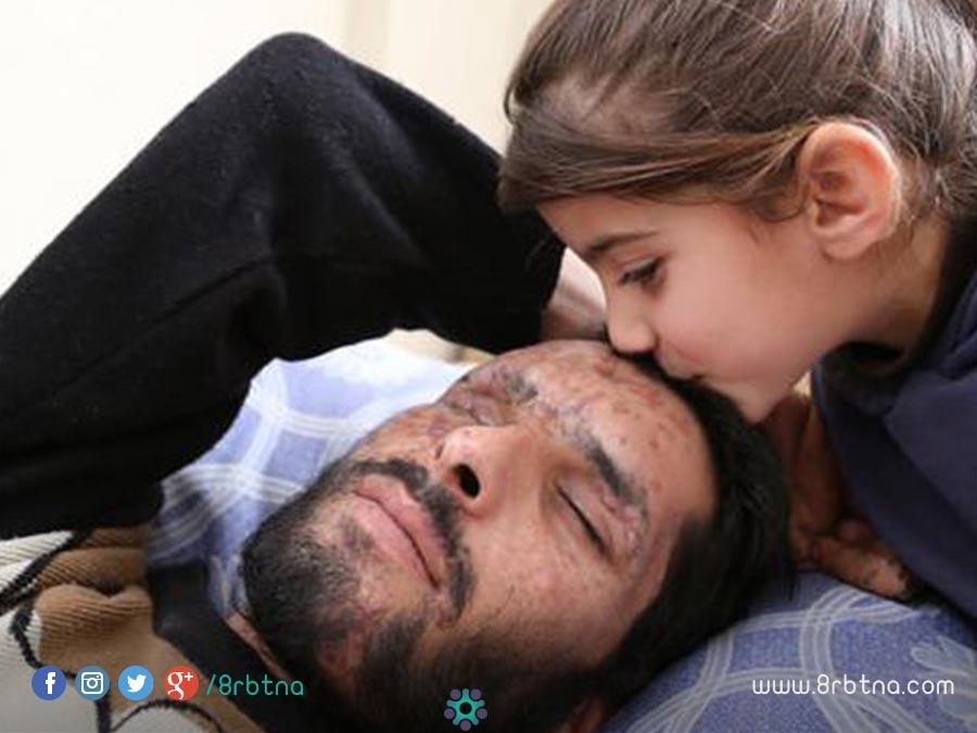 ابنة لاجئ سوري فقد سمعه و بصره في الحرب تناشد الأطباء: خذوا عيوني واعطوها لوالدي