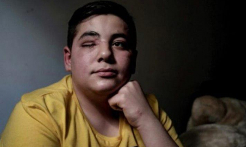 تعاطف فرنسي مع طفل سوري فقد عينه باحتجاجات فرنسا